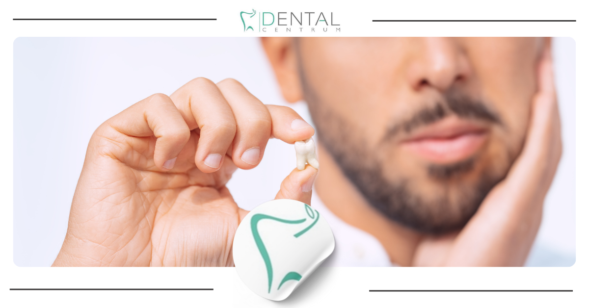 Rekonwalescencja po ekstrakcji zęba